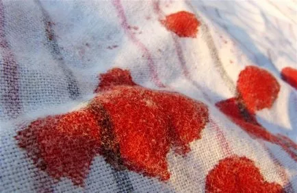 Cum te-ai infectat cu HIV prin sange pot fi infectate cu sânge contaminat de băut după cum este necesar