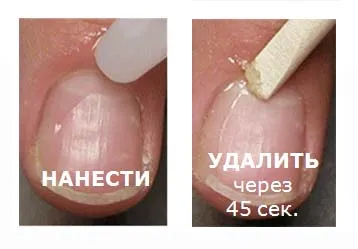 Cum de a elimina cuticulele fara circumcizie (circumcizia) Cum de a elimina cuticulele fără tăiere