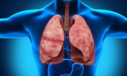 Cum de a consolida plămânii și bronhiile 1 (bronhii) Cum de a consolida plămânii și bronhiile 1