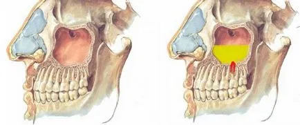 Ca acasă pentru a curăța sinusurile curatarea sinusurilor de mucus