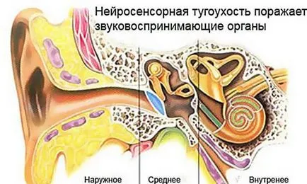 Cum de a restabili audiere ce se întâmplă dacă urechea nu aude (aude) Cum de a restabili audiere ce se întâmplă dacă urechea nu aude