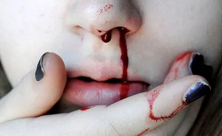 Ce vis sângerează, interpretare de vis - într-un vis de sânge (medie) Ce vis sângerează, interpretare de vis - sange in timpul somnului