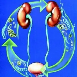 simptome Klebsiella, și Klebsiella pneumonia, Klebsiella într-un frotiu decât vindecarea klebsiellu