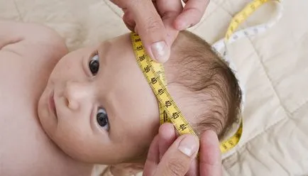 Când ar trebui să fontanela năpădit copilul cum să aibă grijă de ei (fontanela) Când ar trebui să fontanela năpădit copilul cum să aibă grijă de ei