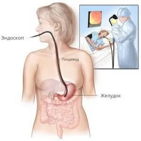 Lump în stomac - provoacă senzația unei protuberanțe, simptome și tratament
