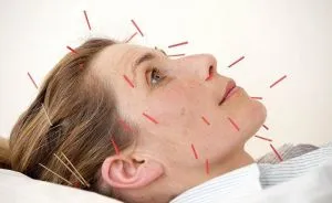 Tratament de nevrită de droguri nervoase trigemen și fizioterapie (nevrită de trigemen tratamentul simptomelor nervoase) Tratament de nevrită de droguri nervoase trigemen si fizioterapia