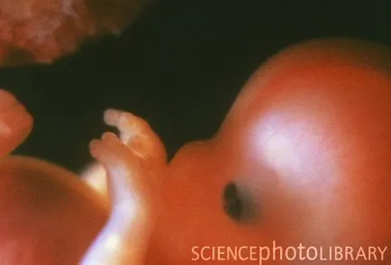 fetale săptămână de săptămână, cu fotografii uimitoare și imagini