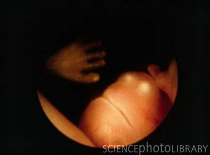 fetale săptămână de săptămână, cu fotografii uimitoare și imagini