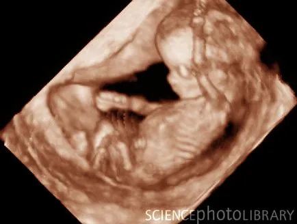 fetale săptămână de săptămână, cu fotografii uimitoare și imagini