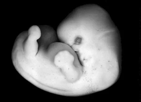 fetale săptămână de săptămână, cu fotografii uimitoare și imagini