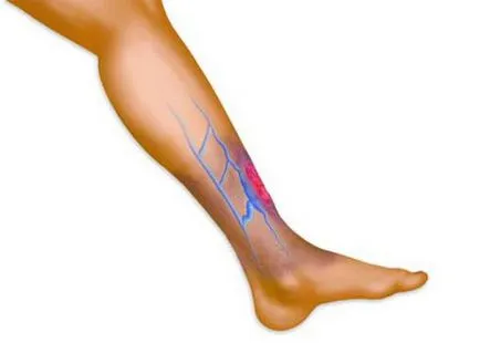 Cai putere (gel) analizează recomandările medicilor (cal) Cai putere (gel) recenzii recomandările medicale