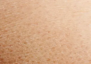 Cel mai bun crema pentru foarte uscat si piele sensibila (crema pentru piele foarte uscata) Cel mai bun crema pentru piele foarte uscata si sensibila