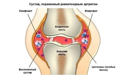 Indicații magnetice terapie și contraindicații, avantaje și prejudicii, utilizarea la domiciliu (utilizare) Indicații magnetice terapie și contraindicații, avantaje și prejudicii, utilizarea de acasă