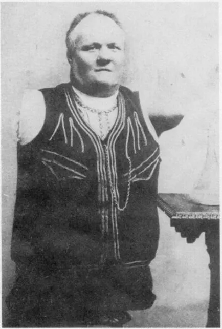 Oamenii-torsos ca ei trăiesc (trăit), fără brațe și picioare sursa de buna dispozitie (oameni-SARS) Oamenii-torsos ca ei trăiesc (trăit), fără brațe și picioare sursă de bună dispoziție