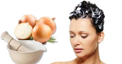 Masca pentru chelie pentru femei sau alopecie trata la domiciliu