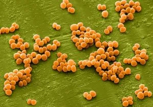 Medicina tradițională și tratament la domiciliu Staphylococcus și Streptococcus tratament gât de remedii populare