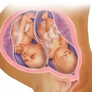 modalități tradiționale de a concepe gemeni sau gemeni (Folk) modalități tradiționale de a concepe gemeni sau gemeni