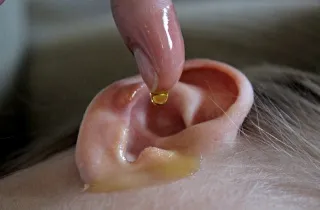 remedii populare pentru earache - decât pentru tratarea adulților la domiciliu (adulți) remedii populare pentru earache - decât în tratamentul adulților la domiciliu