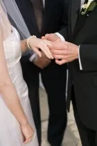 piele foarte uscat de mâini