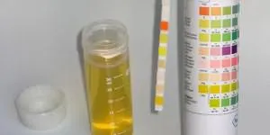 Descris într-un sonnik vis pentru adulți