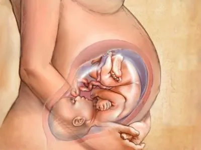 leziuni ale creierului organice care această boală, dacă acesta poate fi tratat