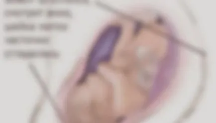 partea inferioară a abdomenului înainte de naștere (în față) partea inferioară a abdomenului înainte de naștere