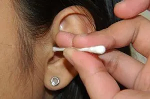 Tratamentul de cerumen și medicamente, picături și remedii populare