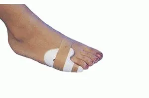 Fractura degetului mic asupra simptomelor sale picior și de prim ajutor (fracturi) Fractura degetului mic asupra simptomelor sale picior și prim ajutor