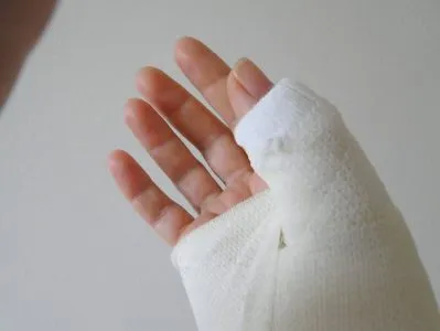 Fractura degetul mic, degetul mare asupra simptomelor de mână și tratament, cum să identifice