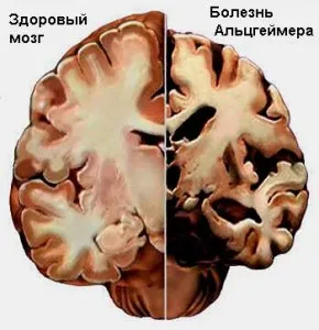 Piracetam, clevermindru