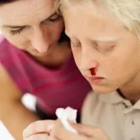 De ce copilul merge de multe ori epistaxis - Cauze