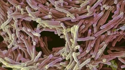 După restabilirea tuberculozei pulmonare