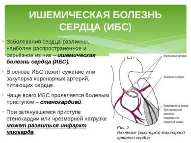 Prezentare - prevenirea bolilor cardiovasculare - free download