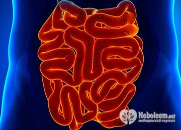 Probleme digestive - spasme intestinale