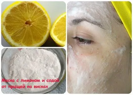 Acnee pe tâmple sfaturi pentru dereticare piele (piele) Acnee pe tâmple sfaturi pentru piele așez
