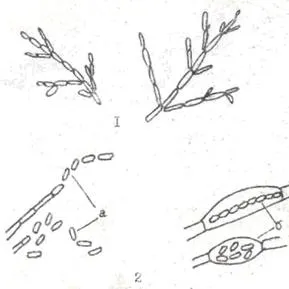 Reproducerea și clasificarea drojdiilor (cauza fermentației alcoolice viguroase) Reproducerea și clasificarea drojdiei