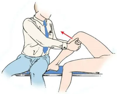 semne incrucisat anterior ruptura de ligamente, tratament, reabilitare (pauză) semne frontali ruptura ligamentului incrucisat, tratament, reabilitare