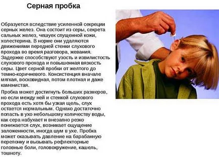 Cerumen în ureche - ce să facă, cum să-l eliminați