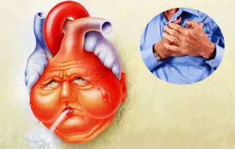 Simptomele insuficienței cardiace la femei, tratament inima (femei) Simptomele insuficienței cardiace la femei, tratament inima