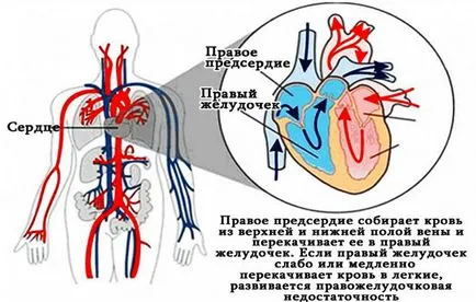 Simptomele insuficienței cardiace la femei, tratamentul cardiac (simptomele) Simptomele insuficienței cardiace la femei, tratament inima