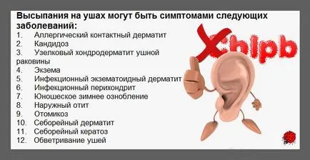 Rashes pe urechi
