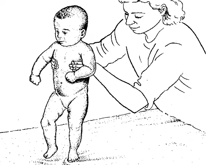 Simptome si hipertonicitate cauze nou-născut pe măsură ce trece si optiunile de tratament (băi de masaj și (hipertonia) Simptomele și cauzele hiper neonatală, atunci când a avut loc și opțiunile de tratament (masaj, băi și
