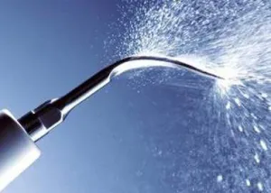 Cât costă o curatare dentara la dentist