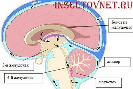 Moartea ca urmare a accident vascular cerebral - realitate sau speculații