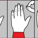 Pielea uscata pe mâini - cauze, tratamentul și prevenirea