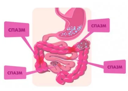 Spasmele intestinului cauze și tratament (motive) Spasmele cauzele intestinului și tratamentul