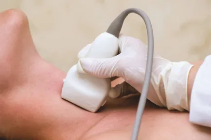 vasospasmul cerebral cauzele sale, simptomele și tratamentul (spasm) vasospasm cerebral cauzele sale, simptome și tratament