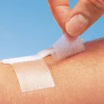 Fondurile din tehnicile de cicatrici populare sau unguent