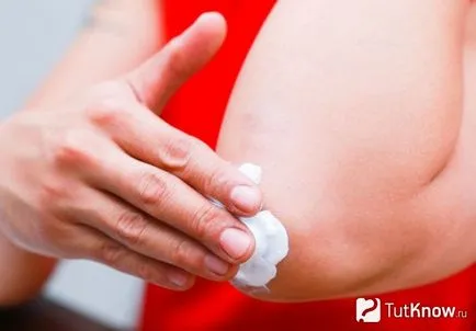 Pielea uscata pe coate