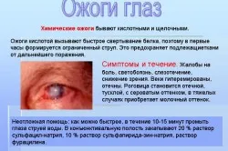 simptome leziuni oculare, cauze, tratament